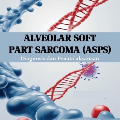 ALVEOLAR SOFT PART SARCOMA (ASPS) DIAGNOSIS DAN PENATALAKSANAAN